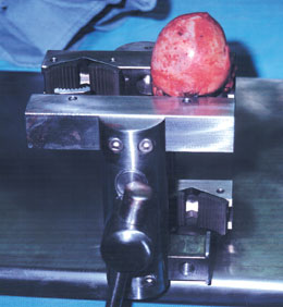 Allograft Bone Vise