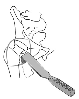 Arm Board