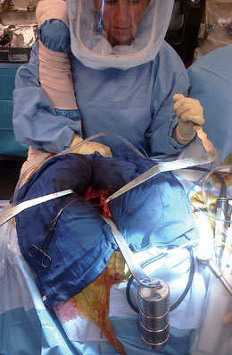 Offset Handle Hip Retractor