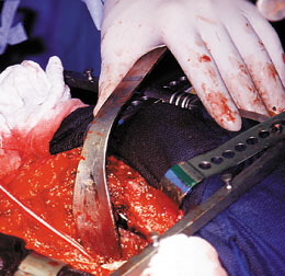 Cobra Retractor – Standard