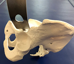 Duke Classic Acetabular Retractor