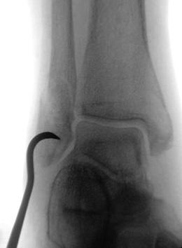 Small Bone Awl