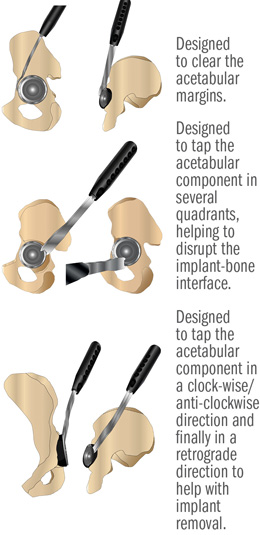 Garneti Hip Cup Revision Osteotome Set