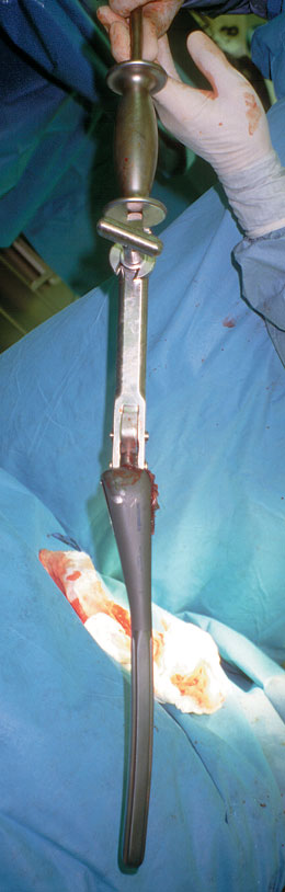 Universal Modular Femoral Hip Component Extractor