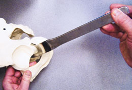 Moran Posterior-Inferior Retractor