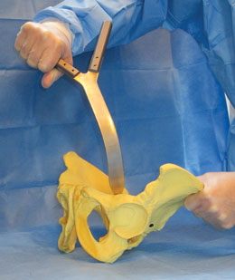 O’Reilly Dual Handle Direct Anterior Retractor