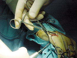 Redler Percutaneous Pin Clamp