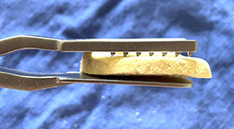Rosenstein Forked UKA Tibial Fragment Grasper