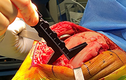 Superior Retractor