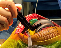 Superior Retractor