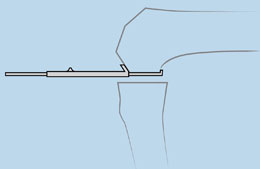 Wilson Condylar Gauge