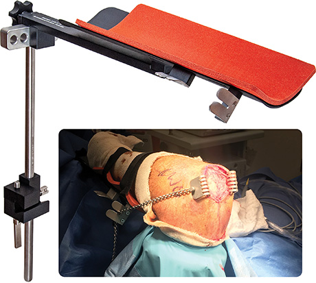 Auerbach Arm Holder Rake Retractor Set