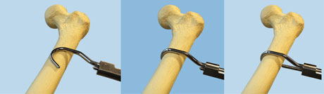 Browner MIS Bone Clamp