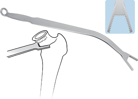 Chandran Femoral Neck Retractor with Sharp Teeth