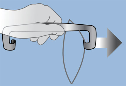 Stanton Forward Retractors