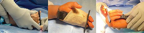 Hand/Finger Positioner