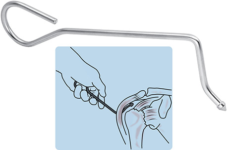 Bacastow Arthroscopic Deltoid Lift Retractor