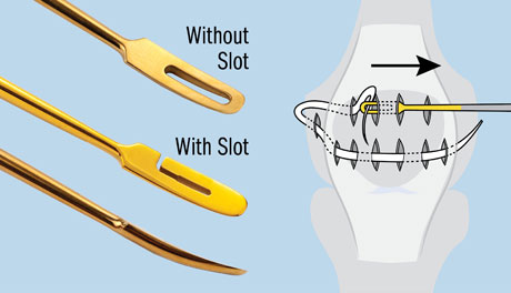 Kodkani Tissue Elevator Suture/Graft Passer