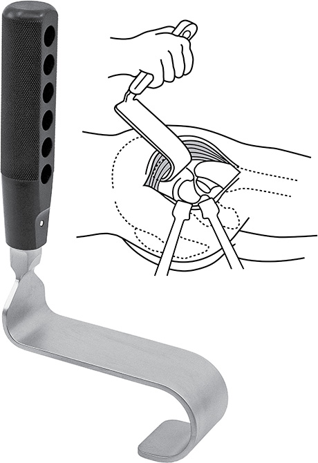 McMaster Abductor Retractor