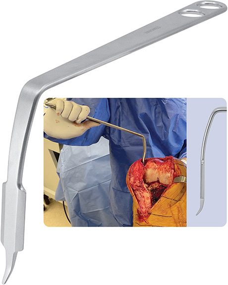 Modified Wide Hohmann Retractor with Taylor Tip