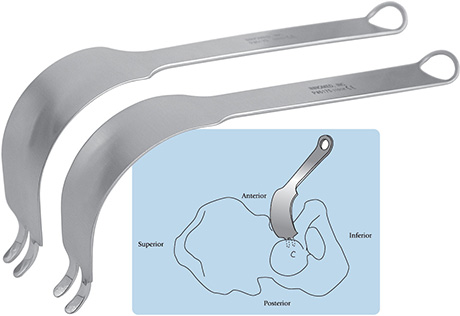Modified Double Prong Acetabular Retractors with Center Prongs