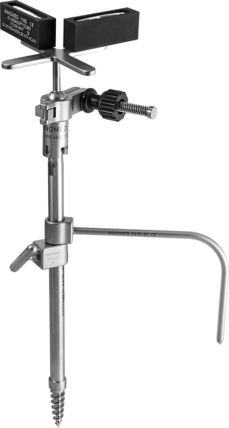 Parsley Intraoperative Leg Length Device