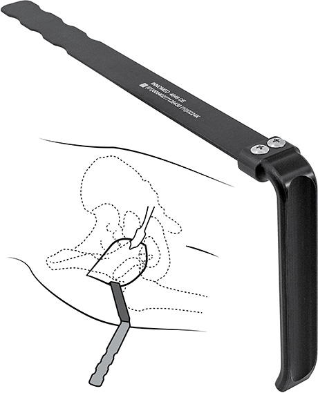 Sierra OrthoLucent™ Soft Tissue Retractor