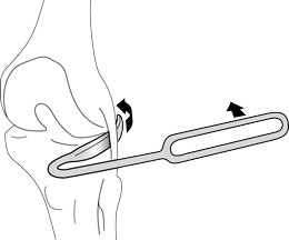 Blount Knee Retractor