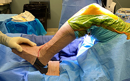 Lombardi Leg Positioner