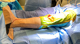 Lombardi Leg Positioner