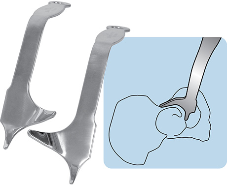 Posterior-Inferior Retractors